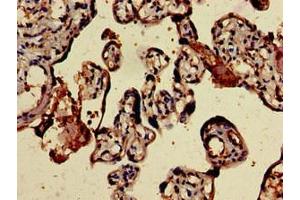 Immunohistochemistry of paraffin-embedded human placenta tissue using ABIN7145708 at dilution of 1:100 (BMPR1B 抗体  (AA 14-126))