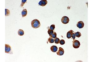 Anti- Parkin Picoband antibody, ICC ICC: NEURO-2α Cell (Parkin 抗体  (AA 23-416))