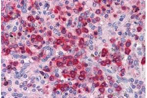 Spleen, Human: Formalin-Fixed, Paraffin-Embedded (FFPE) (ELANE 抗体)