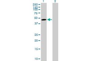 Western Blot analysis of TNFRSF10B expression in transfected 293T cell line by TNFRSF10B MaxPab polyclonal antibody.