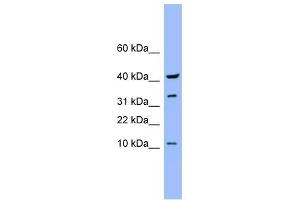 WB Suggested Anti-CASP6 Antibody Titration: 0.