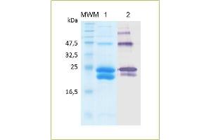 SDS-PAGE and Western blot analysis of human recombinant sRANKL. (RANKL Protein (AA 70 – 244) (His tag))