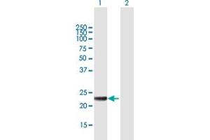 Western Blot analysis of MED20 expression in transfected 293T cell line by MED20 MaxPab polyclonal antibody. (MED20 抗体  (AA 1-212))