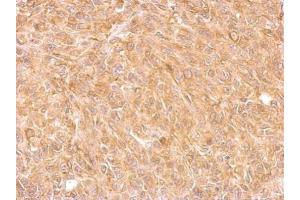 IHC-P Image AKR7A2 antibody detects AKR7A2 protein at cytosol on SkHep1 xenograft by immunohistochemical analysis. (AKR7A2 抗体)
