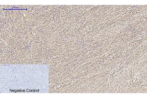 Immunohistochemical analysis of paraffin-embedded human uterus tissue.