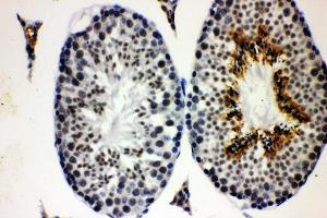 IHC analysis of CCNE1 using anti-CCNE1 antibody (ABIN7601193).