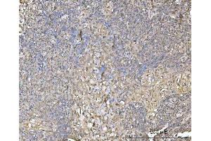 IHC analysis of XAF1 using anti-XAF1 antibody (ABIN7600450).