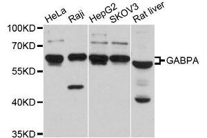 Western blot analysis of extracts of various cell lines, using GABPA antibody. (GABPA 抗体  (AA 1-100))