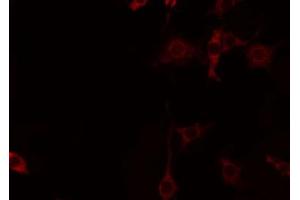 ABIN6274451 staining Hela by IF/ICC. (CNKSR2 抗体  (Internal Region))