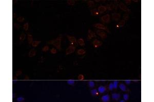 Immunofluorescence analysis of 293T cells using FXN / FRataxin Polyclonal Antibody at dilution of 1:100 (40x lens). (Frataxin 抗体)