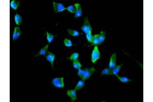Immunofluorescence staining of SH-SY5Y cells with ABIN7168374 at 1:100, counter-stained with DAPI. (MEX3B 抗体  (AA 253-375))