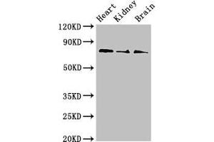 Western Blot Positive WB detected in: Mouse heart tissue, Mouse kidney tissue, Mouse brain tissue All lanes: SLC5A1 antibody at 4 μg/mL Secondary Goat polyclonal to rabbit IgG at 1/50000 dilution Predicted band size: 74, 61 kDa Observed band size: 74 kDa (SLC5A1 抗体  (AA 564-643))