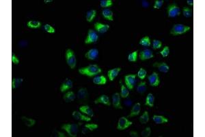 Immunofluorescence (IF) image for anti-ATPase, Ca++ Transporting, Plasma Membrane 3 (ATP2B3) (AA 1057-1220) antibody (ABIN7163516)