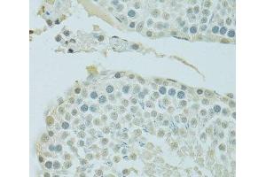 Immunohistochemistry of paraffin-embedded Rat testis using BRD3 Polyclonal Antibody at dilution of 1:100 (40x lens). (BRD3 抗体)