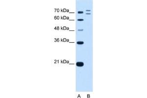 Western Blotting (WB) image for anti-Ring Finger Protein 168 (RNF168) antibody (ABIN2462696) (RNF168 抗体)