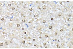 Immunohistochemistry of paraffin-embedded Rat liver using CSNK2A1 Polyclonal Antibody at dilution of 1:100 (40x lens). (CSNK2A1/CK II alpha 抗体)