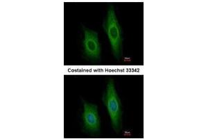 ICC/IF Image Immunofluorescence analysis of methanol-fixed HeLa, using DNase I, antibody at 1:200 dilution. (DNASE1 抗体)