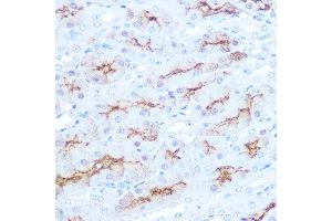 Immunohistochemistry of paraffin-embedded mouse kidney using CD138/Syndecan-1 Rabbit mAb (ABIN1683195, ABIN3018651, ABIN3018652 and ABIN7101639) at dilution of 1:100 (40x lens). (Syndecan 1 抗体)