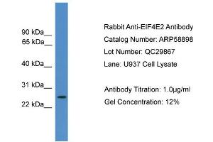 WB Suggested Anti-EIF4E2  Antibody Titration: 0. (EIF4E2 抗体  (N-Term))