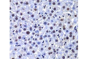 Immunohistochemistry of paraffin-embedded Mouse liver using PRKDC Polyclonal Antibody at dilution of 1:100 (40x lens). (PRKDC 抗体)
