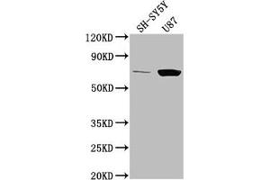 Western Blot Positive WB detected in: SH-SY5Y whole cell lysate, U87 whole cell lysate All lanes: TP73 antibody at 1:2000 Secondary Goat polyclonal to rabbit IgG at 1/50000 dilution Predicted band size: 70, 55, 54, 45, 62, 60, 65, 50, 48, 63, 39 kDa Observed band size: 70 kDa (Tumor Protein p73 抗体  (AA 537-555))