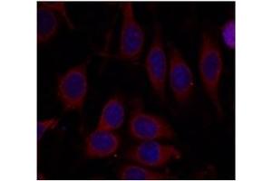 Image no. 3 for anti-Mechanistic Target of Rapamycin (serine/threonine Kinase) (mTOR) (Ser2448) antibody (ABIN319329) (MTOR 抗体  (Ser2448))
