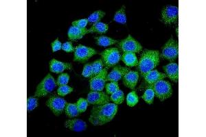 IF analysis of NMI using anti-NMI antibody (ABIN3043451).