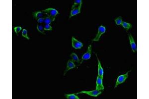 Immunofluorescent analysis of Hela cells using ABIN7175388 at dilution of 1:100 and Alexa Fluor 488-congugated AffiniPure Goat Anti-Rabbit IgG(H+L) (FLT4 抗体  (AA 1112-1329))