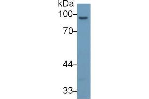 Western Blotting (WB) image for anti-Matrix Metallopeptidase 9 (Gelatinase B, 92kDa Gelatinase, 92kDa Type IV Collagenase) (MMP9) (AA 226-391) antibody (ABIN7427384)