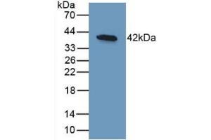 Detection of Recombinant BMP10, Human using Monoclonal Antibody to Bone Morphogenetic Protein 10 (BMP10) (BMP10 抗体  (AA 315-424))