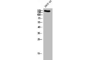 Western Blot analysis of 293T-UV cells using Phospho-NMDAε2 (Y1336) Polyclonal Antibody (GRIN2B 抗体  (pTyr1336))