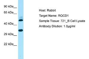Host: Rabbit Target Name: RQCD1 Sample Type: 721_B Whole Cell lysates Antibody Dilution: 1. (RQCD1 抗体  (Middle Region))