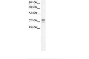 Image no. 1 for anti-Asialoglycoprotein Receptor 1 (ASGR1) (AA 100-149) antibody (ABIN6736268) (Asialoglycoprotein Receptor 1 抗体  (AA 100-149))