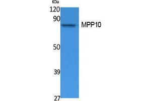 Western Blotting (WB) image for anti-M-Phase phosphoprotein 10 (U3 Small Nucleolar Ribonucleoprotein) (MPHOSPH10) (Internal Region) antibody (ABIN3187640) (MPHOSPH10 抗体  (Internal Region))