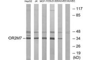 Western blot analysis of extracts from HuvEc/COLO/MCF-7/Jurkat/HepG2 cells, using OR2M7 Antibody. (OR2M7 抗体  (AA 241-290))