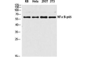 Western Blot (WB) analysis of KB HeLa 293T 3T3 lysis using NFkappaB-p65 antibody.