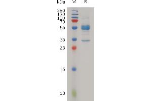 Human M Protein, hFc Tag on SDS-PAGE under reducing condition.