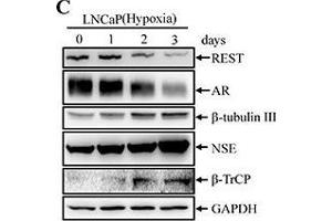 Hypoxia induces NED of LNCaP cells concomitant with down-regulation REST protein levels but not REST mRNA(A) LNCaP cells were treated with hypoxia (2 % O2) for 3 days. (BTRC 抗体)