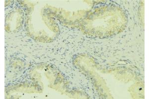 ABIN6272461 at 1/100 staining Mouse colon tissue by IHC-P. (WASF1 抗体  (Internal Region))