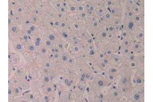 Immunohistochemistry (IHC) image for anti-Arachidonate 5-Lipoxygenase (ALOX5) (AA 461-671) antibody (ABIN7433525)