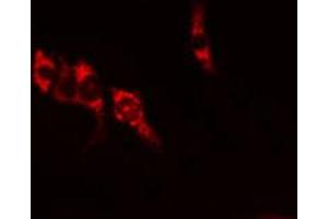 ABIN6269355 staining U-2 OS  cells by IF/ICC. (IL-10RA 抗体  (C-Term))