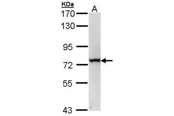 RecQ Protein-Like (DNA Helicase Q1-Like) (RECQL) (C-Term) antibody
