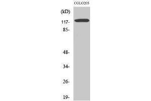 Western Blotting (WB) image for anti-Leptin Receptor (LEPR) (Internal Region) antibody (ABIN3185989) (Leptin Receptor 抗体  (Internal Region))
