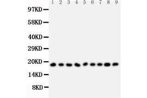 Anti-Ribonuclease A antibody, Western blotting All lanes: Anti Ribonuclease A  at 0. (RNASE1 抗体  (Middle Region))