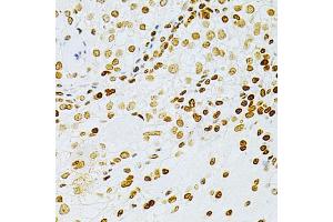 Immunohistochemistry (IHC) image for anti-Dyskeratosis Congenita 1, Dyskerin (DKC1) (AA 245-514) antibody (ABIN1512829)