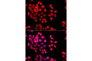 Immunofluorescence analysis of A549 cells using STXBP2 antibody. (STXBP2 抗体)
