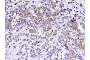IHC analysis of beta Catenin using anti-beta Catenin antibody . (CTNNB1 抗体  (AA 2-233))