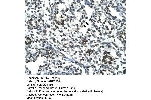 Human Lung (SIRT5 抗体  (Middle Region))