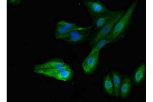 Immunofluorescent analysis of HepG2 cells using ABIN7166940 at dilution of 1:100 and Alexa Fluor 488-congugated AffiniPure Goat Anti-Rabbit IgG(H+L) (MYRIP 抗体  (AA 387-689))