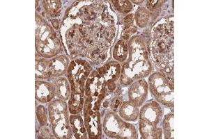 Immunohistochemical staining of human kidney with SAC3D1 polyclonal antibody  shows strong cytoplasmic positivity in cells in tubules at 1:200-1:500 dilution. (SAC3D1 抗体)